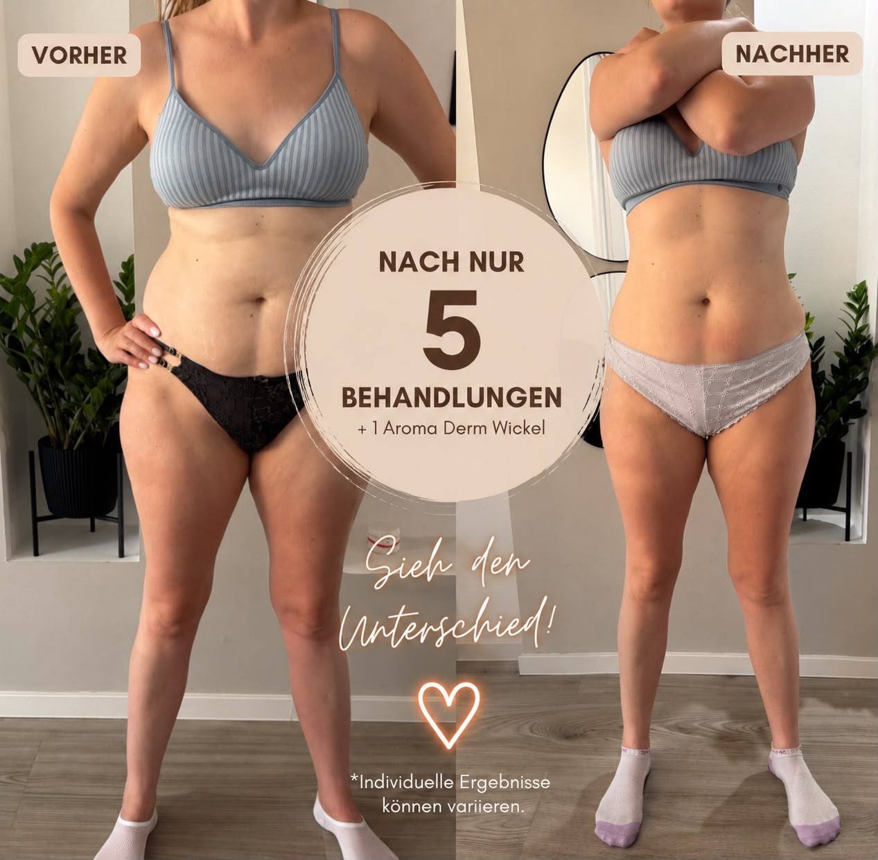 Vorher Nachher Ergebnis 1 – SCULPT Studio Oldenburg